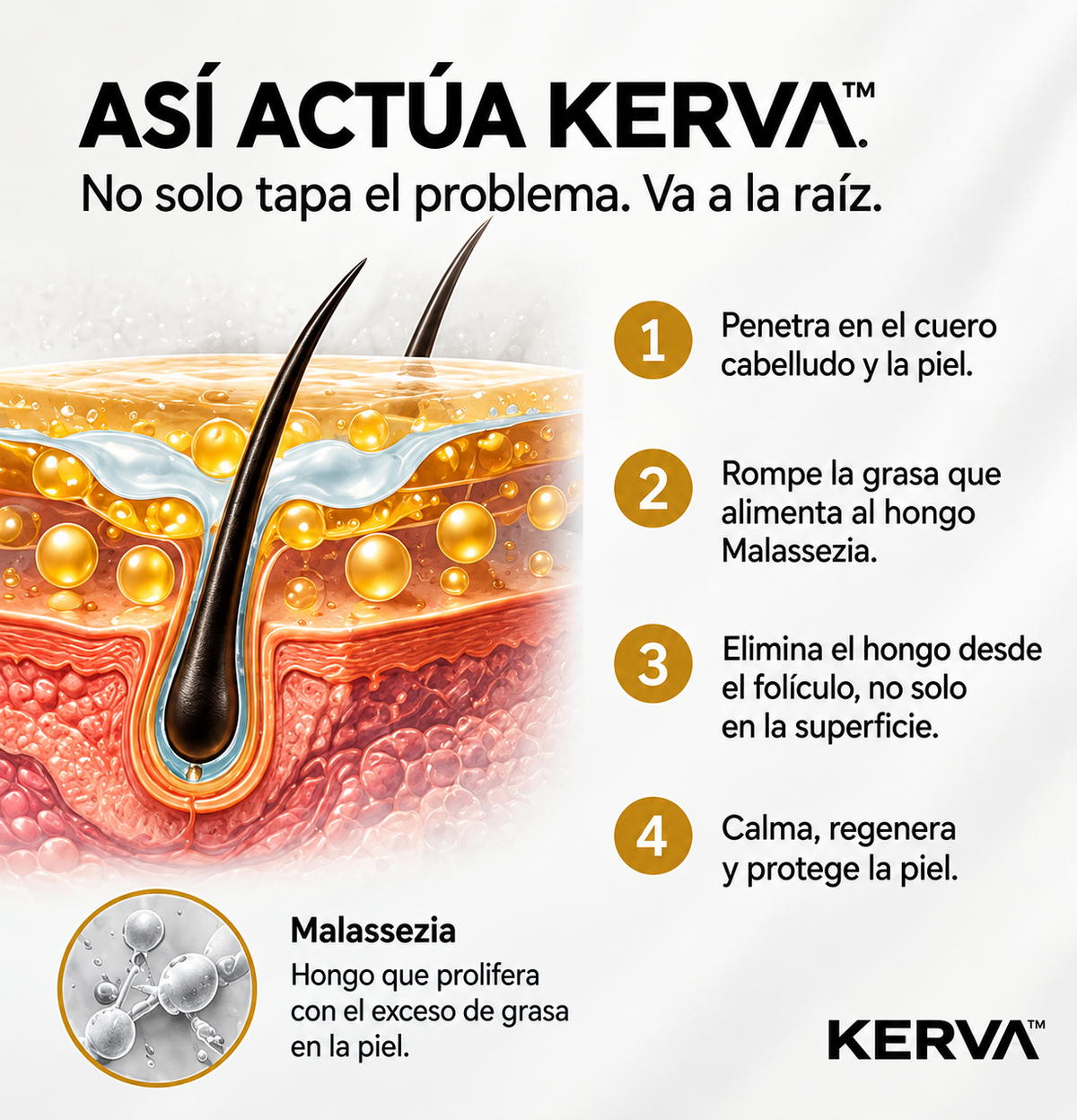 KERVA™ | Crema Antifúngica Permanente contra la Caspa y la Dermatitis Seborreica